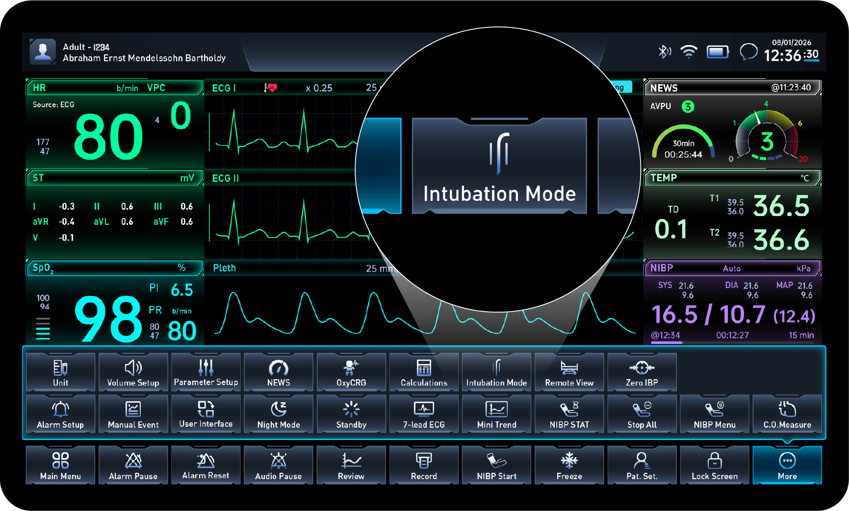 Intubation Mode